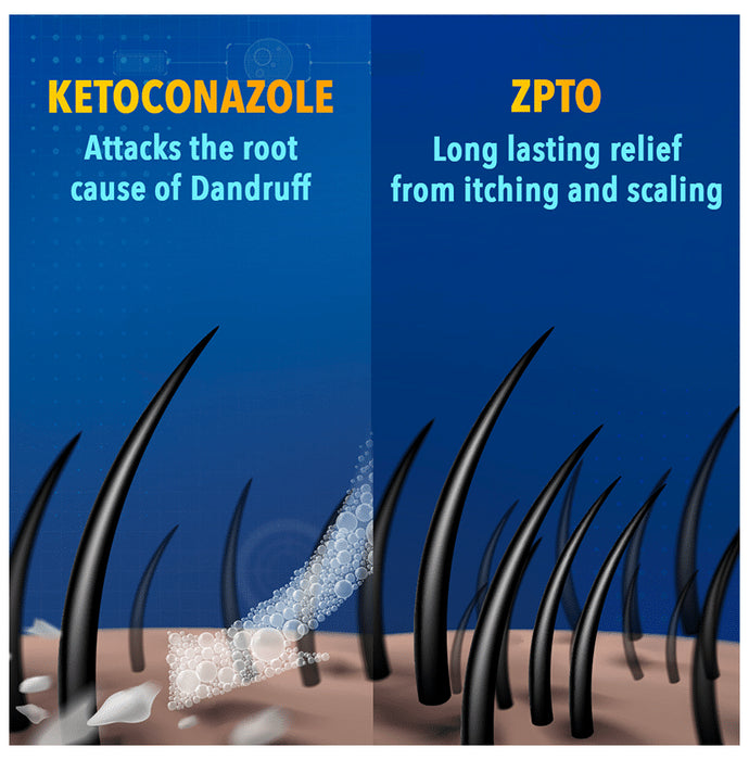 Scalpe+ Expert Anti Dandruff | Hair Care Shampoo