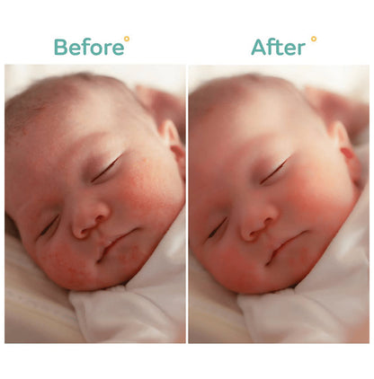 Mylo Powder Veda Baby Ubtan